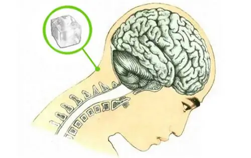 Польза от прикладывания кубика льда к шее