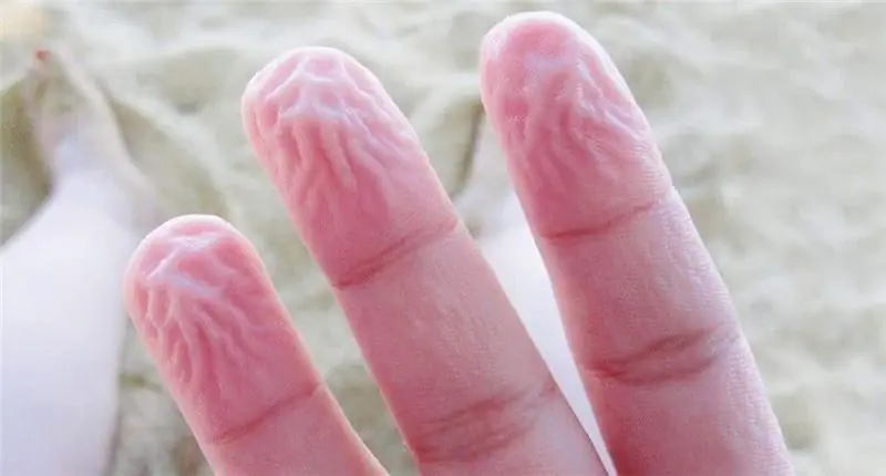 9 странных вещей, которые делает наше тело в качестве защиты, о которых мы не знали