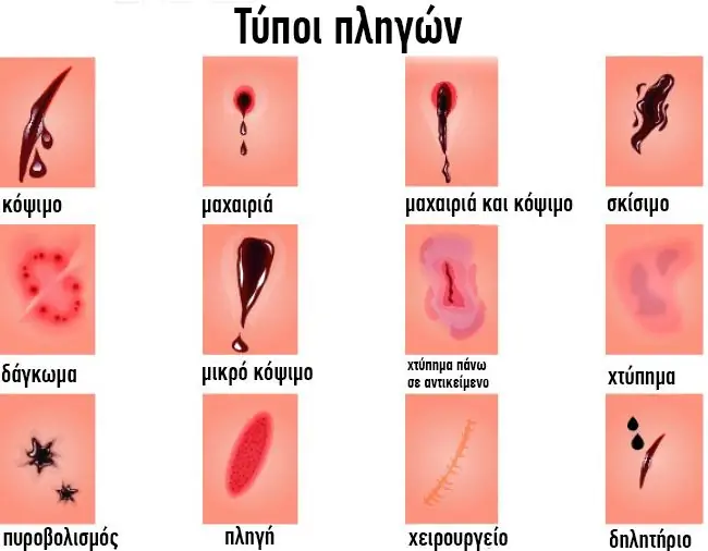 22cc1a9ff988394babe2f804c6bf1b48 22cc1a9ff988394babe2f804c6bf1b48