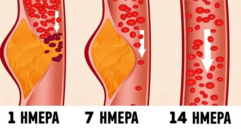 Какую диету медики считают одной из лучших для здоровья?