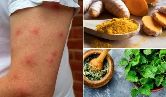 Какие продукты составляют 8 самых распространенных аллергенов?